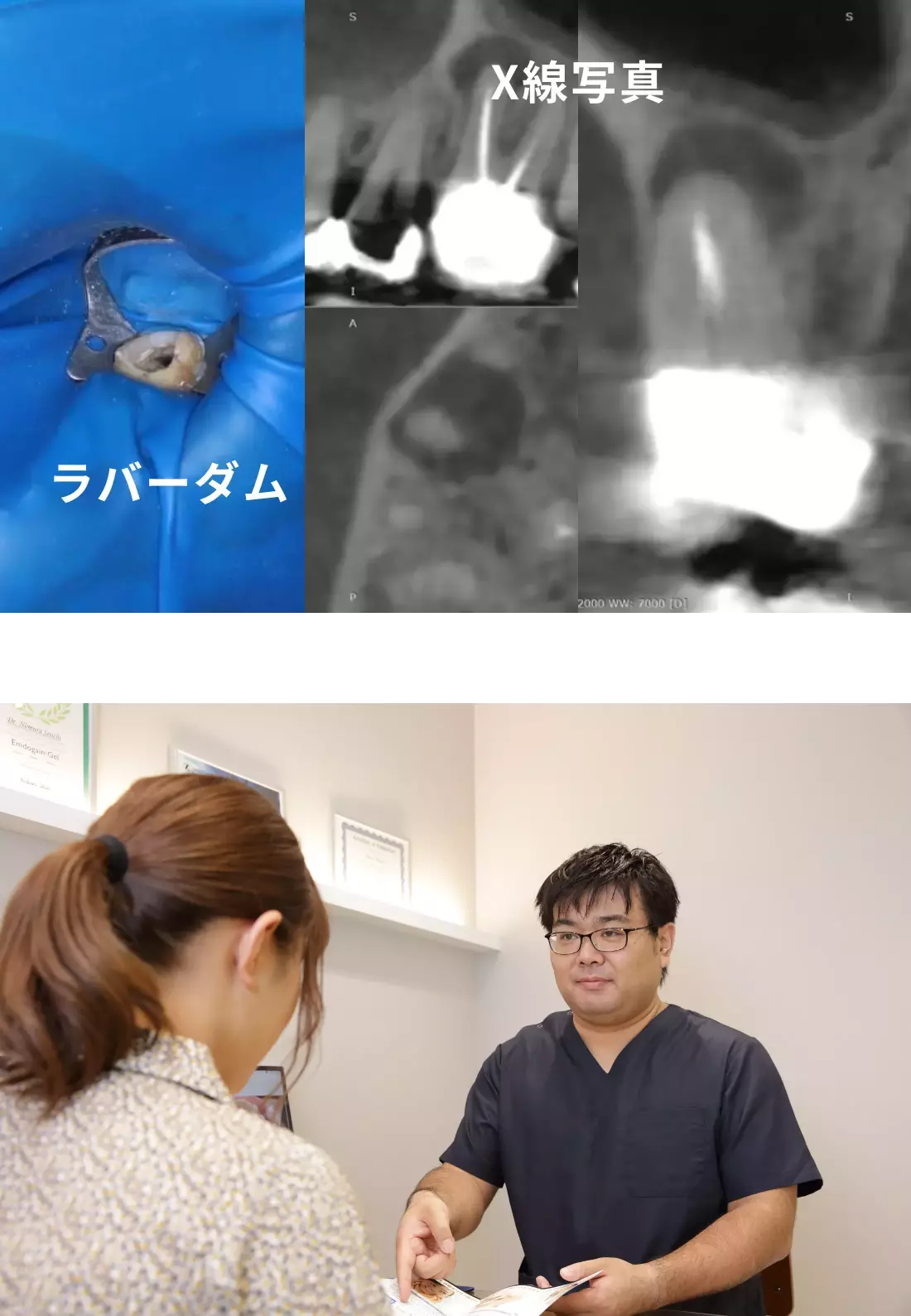 精密なX線写真、ラバーダム防湿