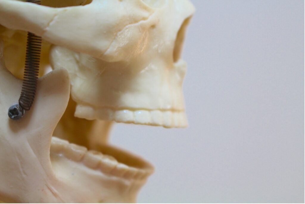 出っ歯の原因とタイプ