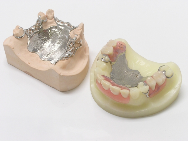 金属床義歯の特徴について